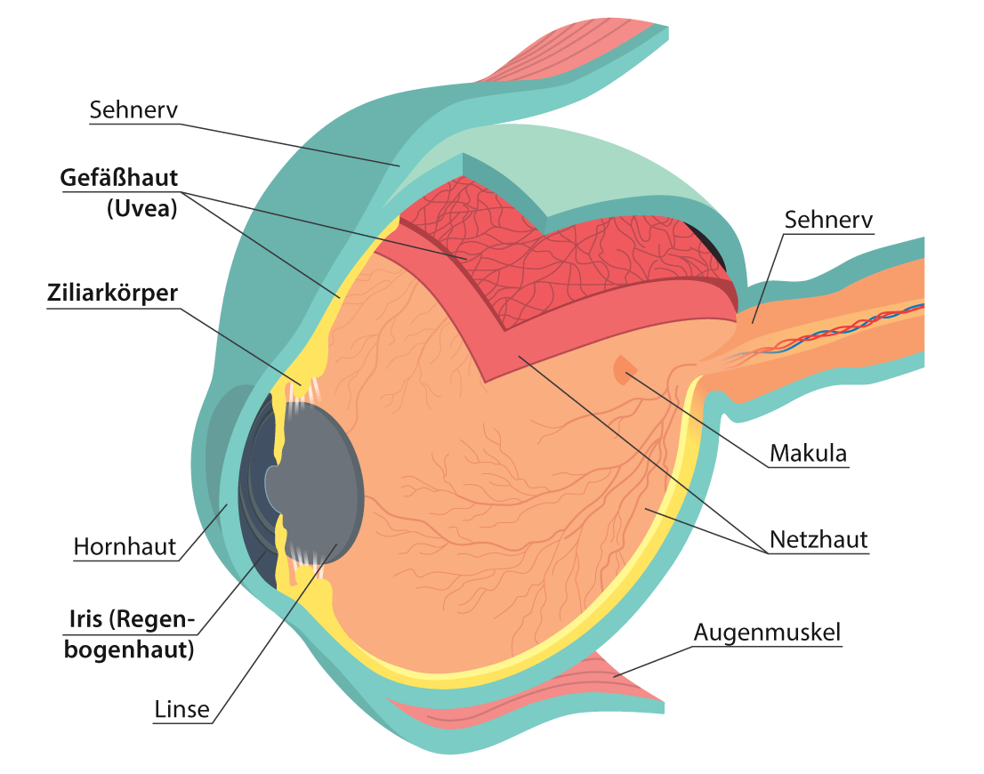 Auge im Querschnitt - Folgen von Bluthochdruck
