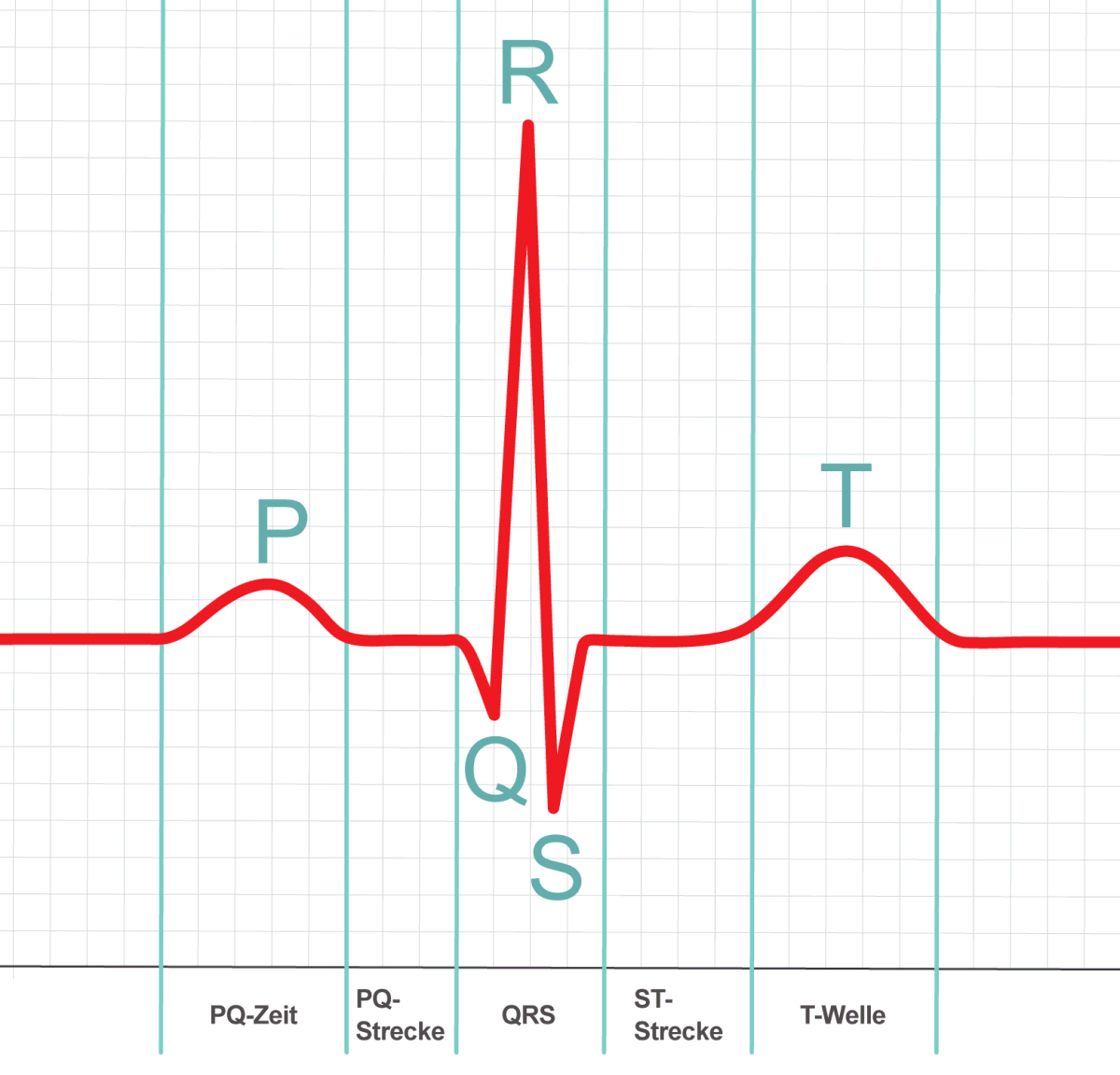 Ausschnitt eines EKG (Elektrokardiogramm)