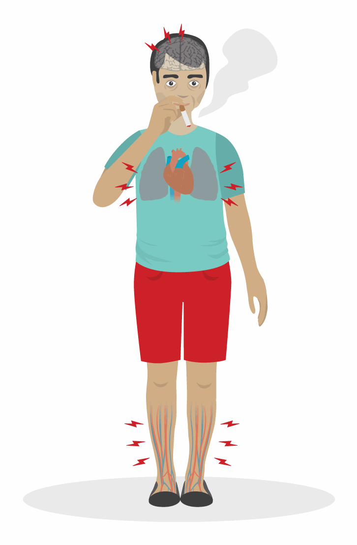 Bluthochdruck durch Rauchen