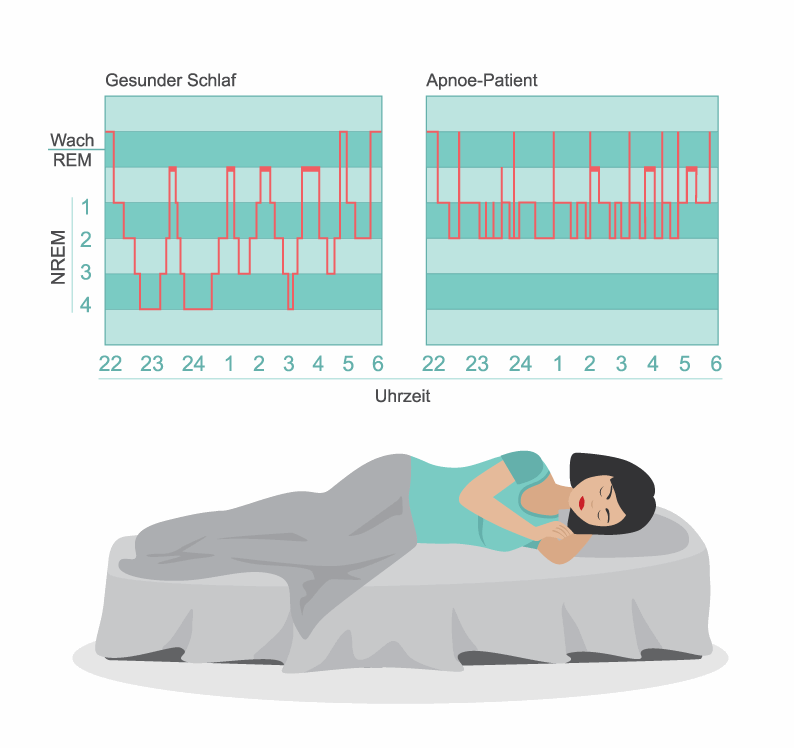 Schlafphasen im Vergleich